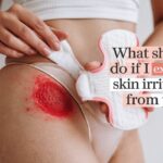 What Should I Do If I Experience Skin Irritation from Pads?